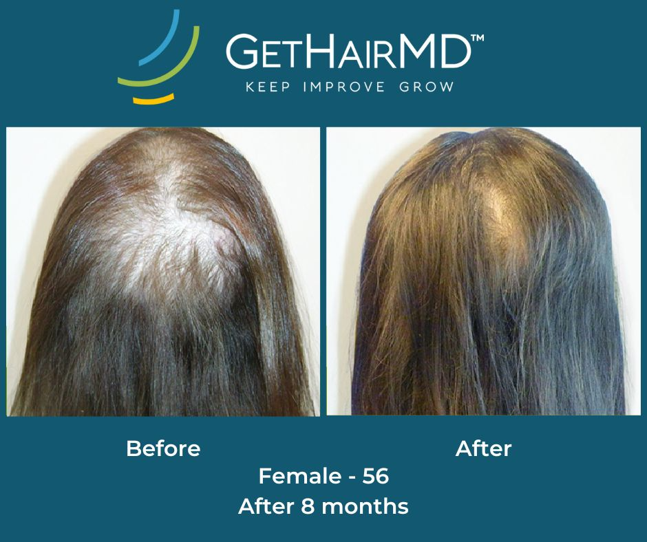 gethairmd