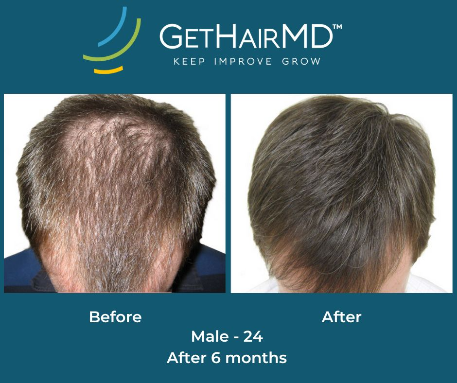 gethairmd