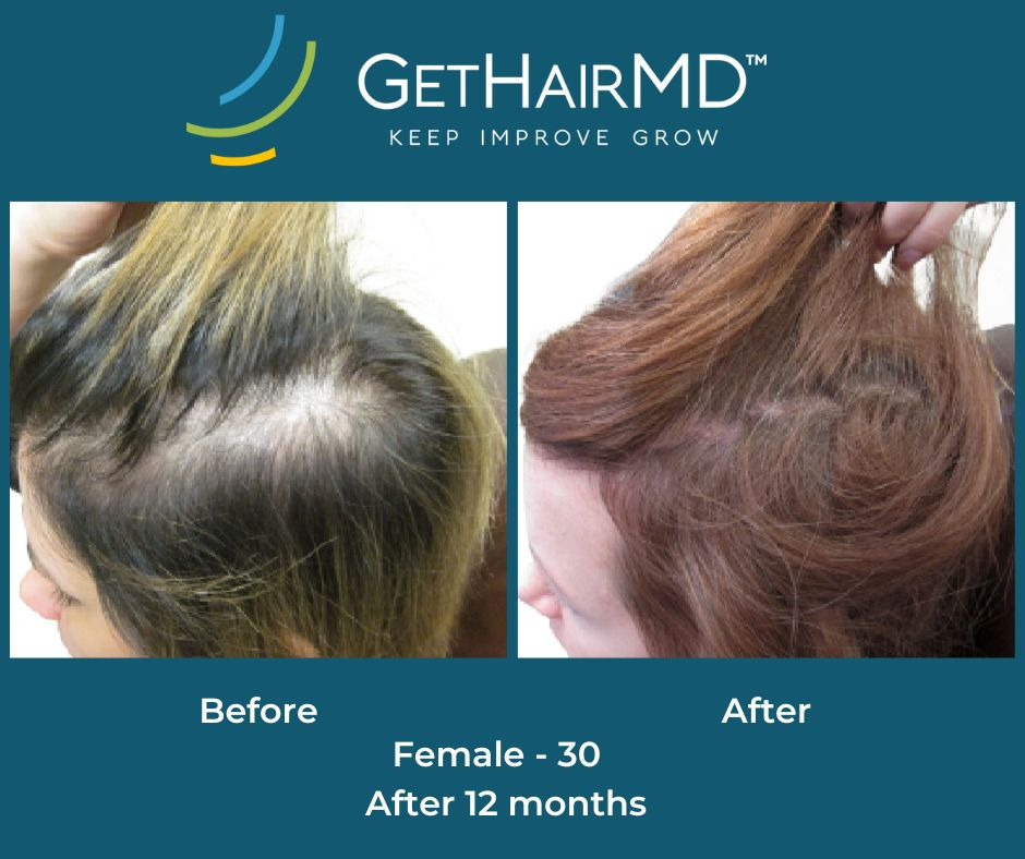 gethairmd