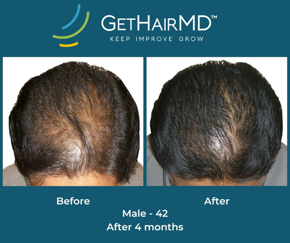 gethairmd