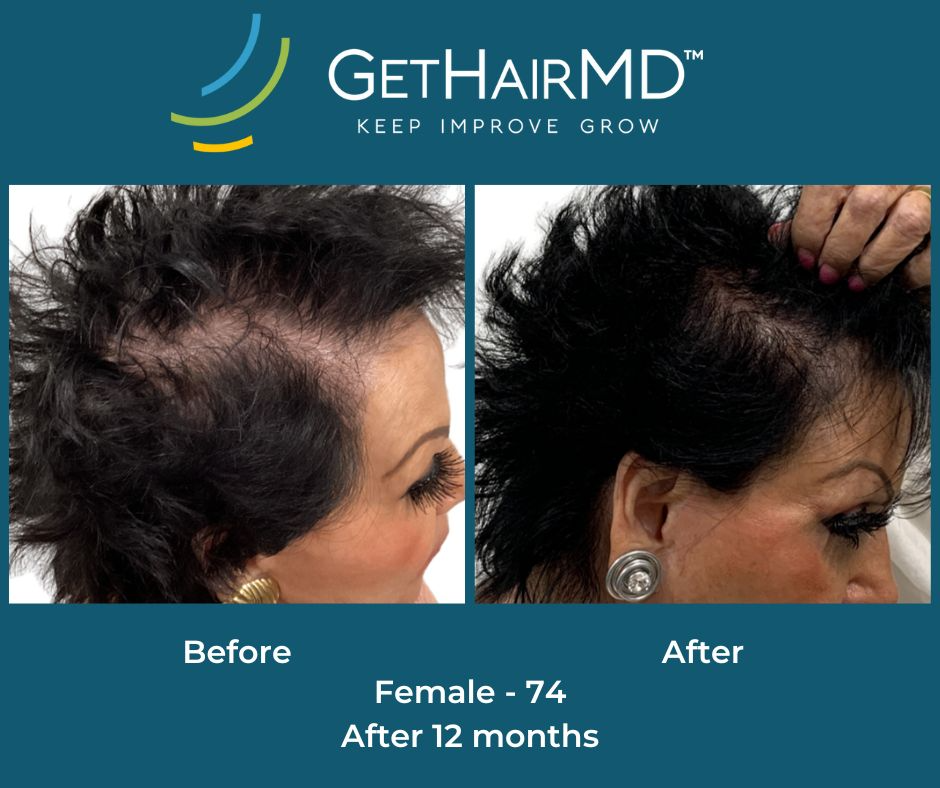 gethairmd