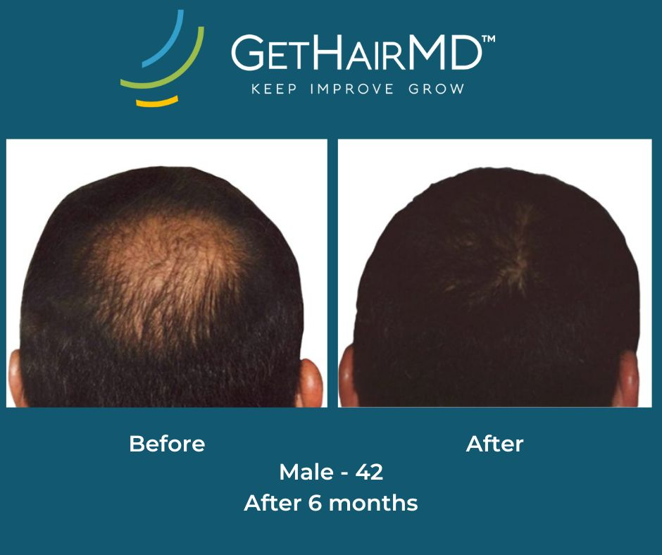 gethairmd