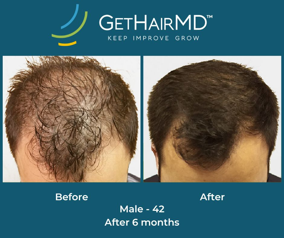 gethairmd