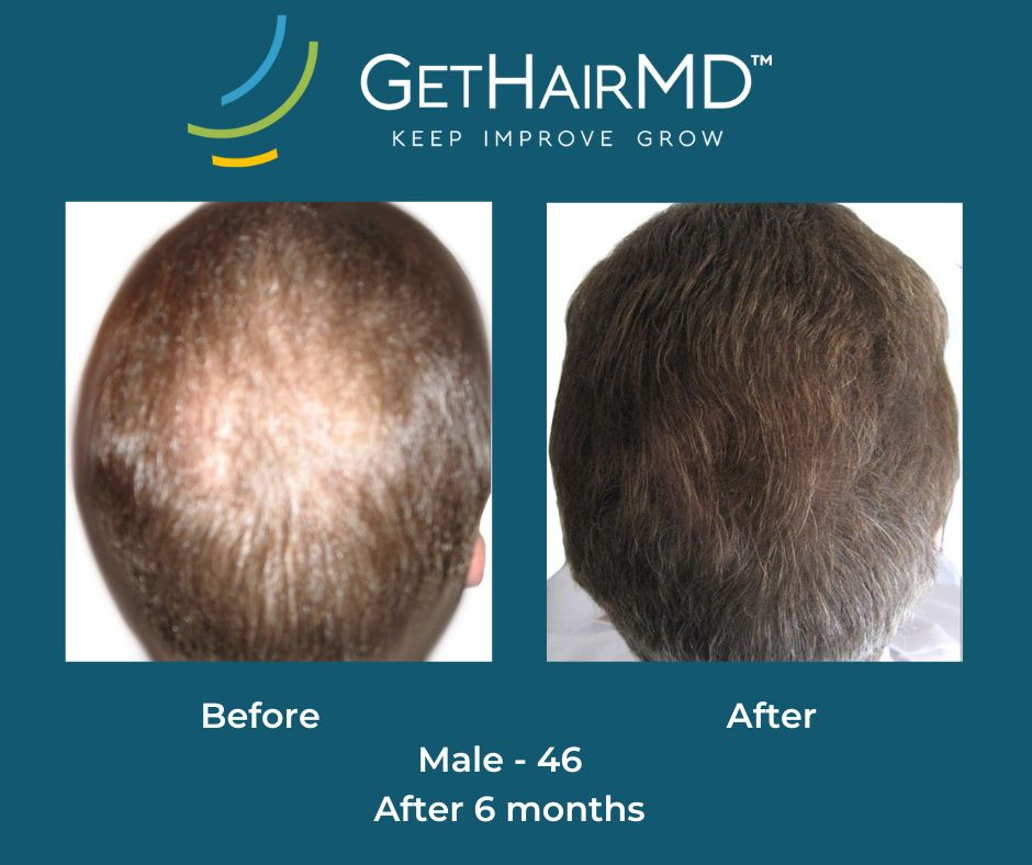 gethairmd